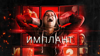 Имплант